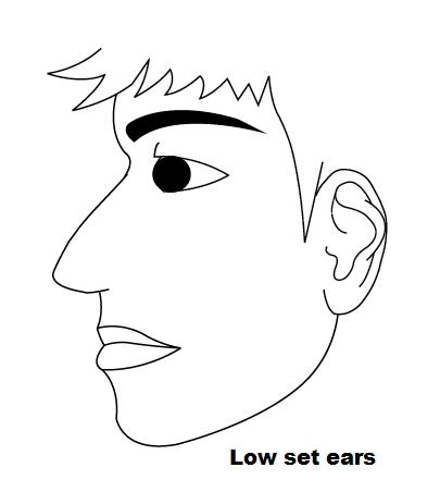 low set ears